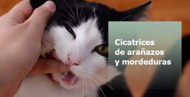 Eliminar cicatrices de arañazos o mordeduras con parches cicatrizantes