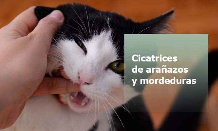 Eliminar cicatrices de arañazos y mordeduras con parches cicatrizantes Eliminar cicatrices de arañazos y mordeduras con parches cicatrizantes