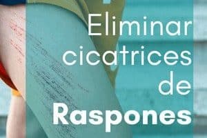 Reducir o eliminar cicatrices de raspones con parches cicatrizantes