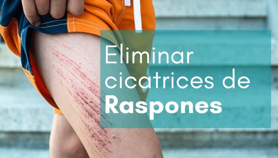 eliminar Cicatrices de raspones Reducir o eliminar cicatrices de raspones con parches cicatrizantes