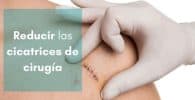 imagen de un medico analizando una cicatriz quirúrgica para reducirla