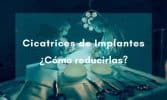 Las diferentes cicatrices por aumento de pecho: Cicatriz Submamaria, Cicatriz Axilar, Cicatriz Areolar o Periareolar