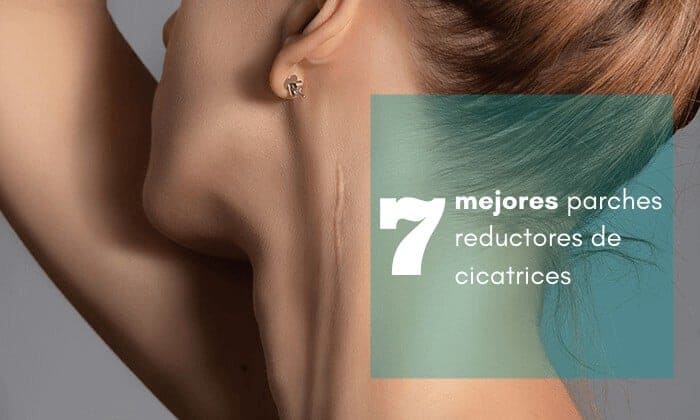 7 mejores parches reductores de cicatrices imagen recortada 7 mejores parches reductores de cicatrices