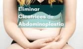 eliminar cicatrices abdominioplastia parches de silicona para cicatrices