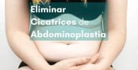 eliminar cicatrices abdominioplastia parches de silicona para cicatrices