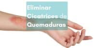 Cómo Eliminar Cicatrices de Quemaduras con Parches Cicatrizantes