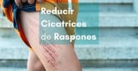 Reducir o eliminar cicatrices de raspones con parches cicatrizantes