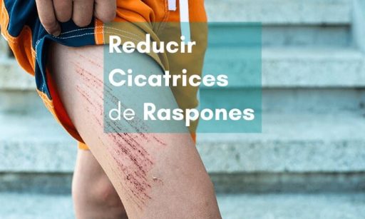 Reducir o eliminar cicatrices de raspones con parches cicatrizantes