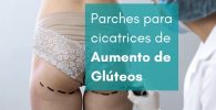 reducir cicatrices en los gluetos con parches cicatrizantes