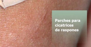 Parches para cicatrices de raspones